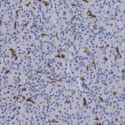 SLC28A3 Antibody, Novus Biologicals:Antibodies:Primary Antibodies
